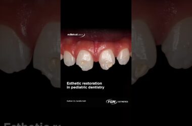 FGM-Opallis-dentist-teethwhitening-dentalcare-whitening-white444-maherzain-arabic