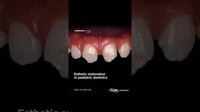 FGM-Opallis-dentist-teethwhitening-dentalcare-whitening-white444-maherzain-arabic